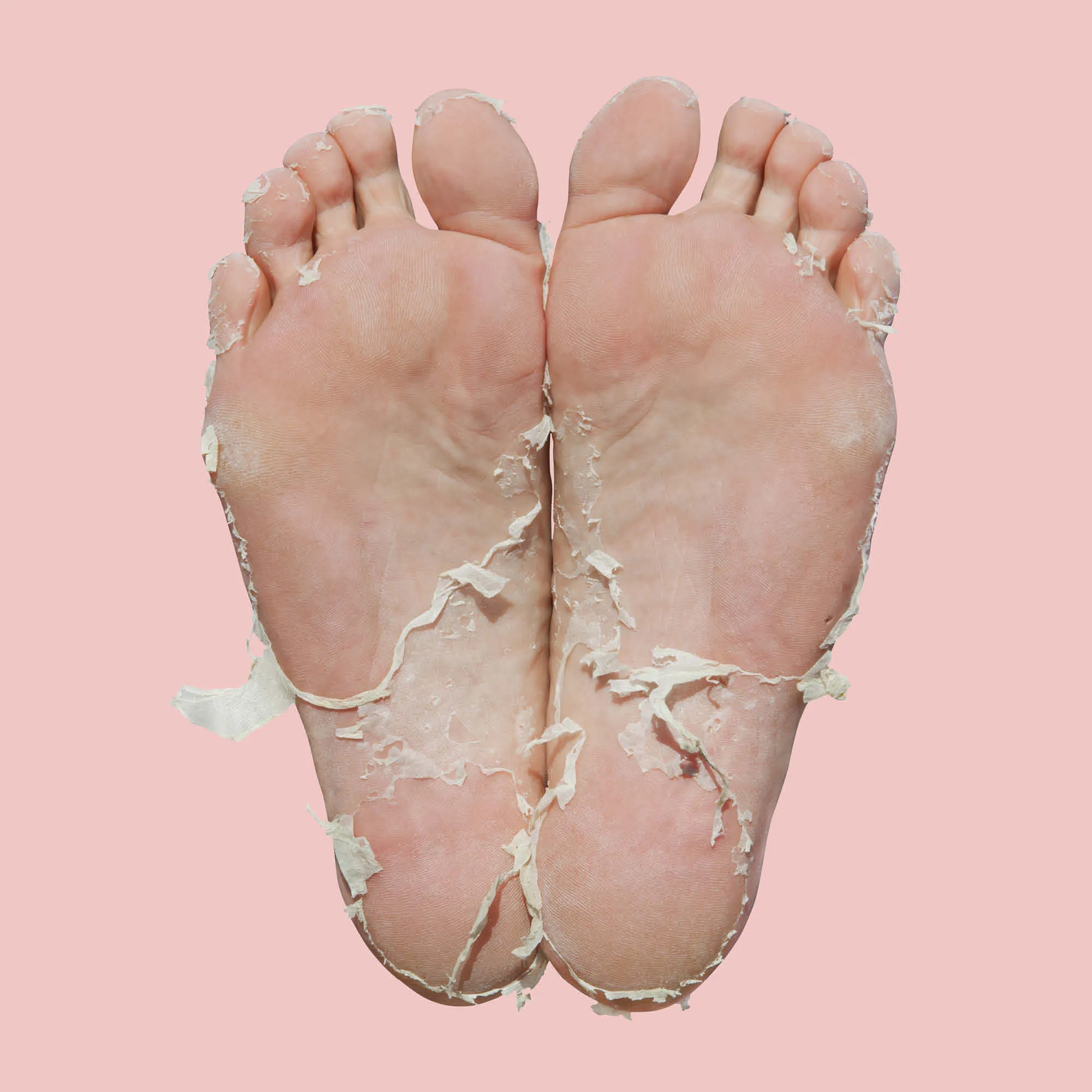 Pedi Peel Max Intensive Exfoliating Treatment (Pack of 10)